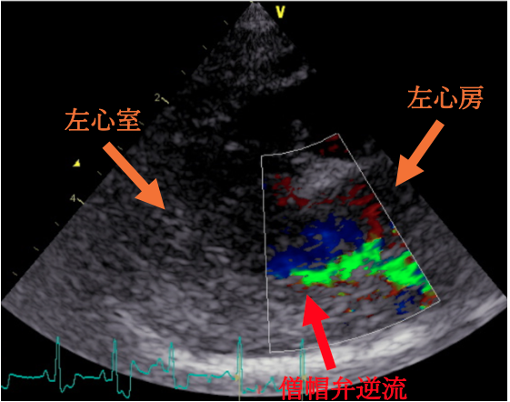心臓超音波検査結果