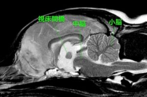 【脳圧正常な患者例】